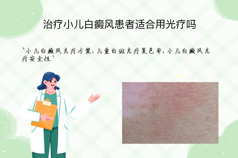 治疗小儿白癜风患者适合用光疗吗