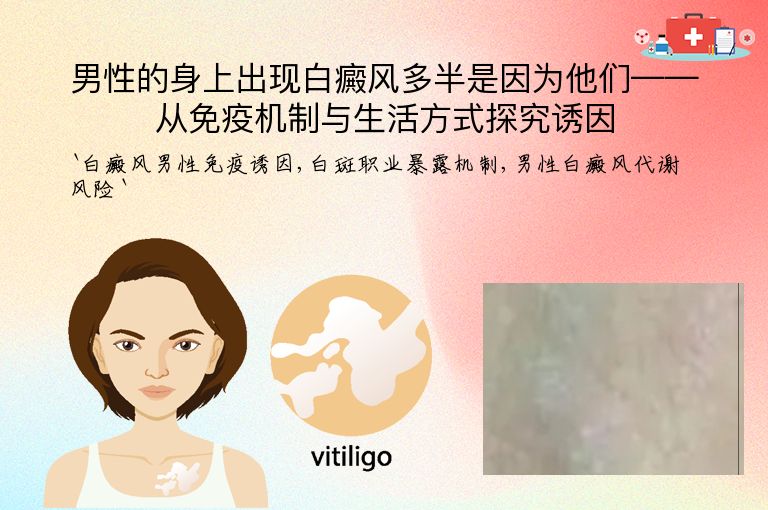 男性的身上出现白癜风多半是因为他们——从免疫机制与生活方式探究诱因