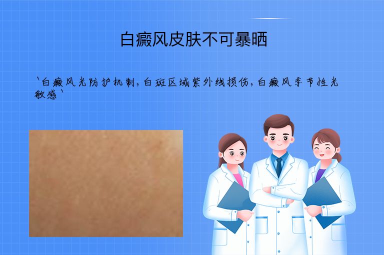 白癜风皮肤不可暴晒