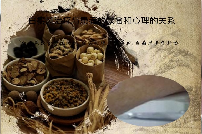 https://www.bdfsjzyy.com/d/file/p/7b1ab9f252f1a03abe50850b7e81f83d.jpeg