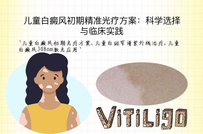 儿童白癜风初期精准光疗方案:科学选择与临床实践