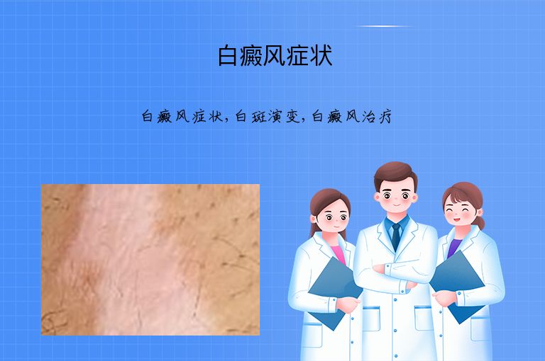 https://www.bdfsjzyy.com/d/file/p/b4cd5a97a5d677f13d7ef51c91142051.jpeg