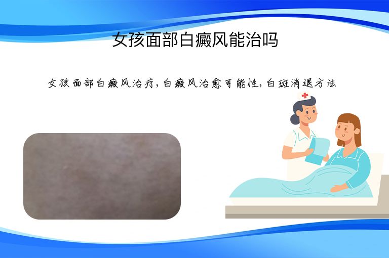 女孩面部白癜风能治吗”