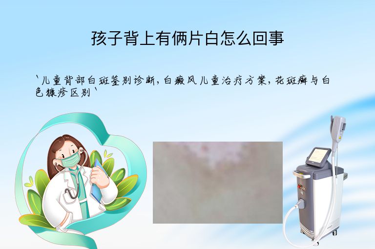 孩子背上有俩片白怎么回事