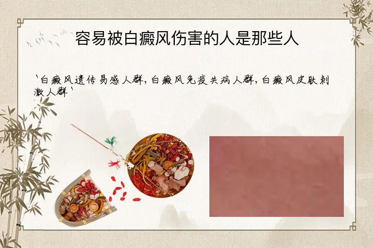 https://www.bdfsjzyy.com/d/file/p/02e886a15769b5e15c2d8ff4f4373824.jpeg