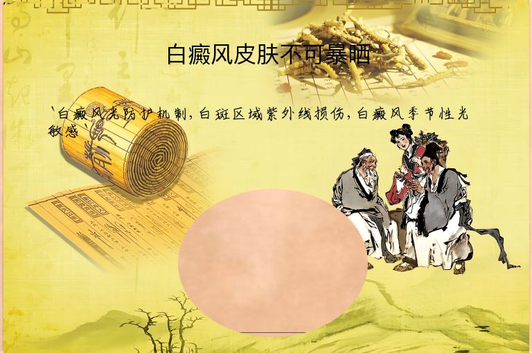 白癜风皮肤不可暴晒