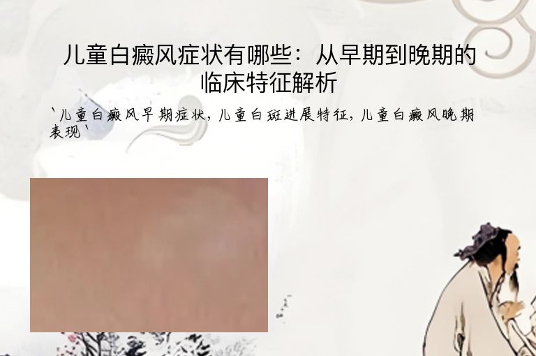 儿童白癜风症状有哪些:从早期到晚期的临床特征解析
