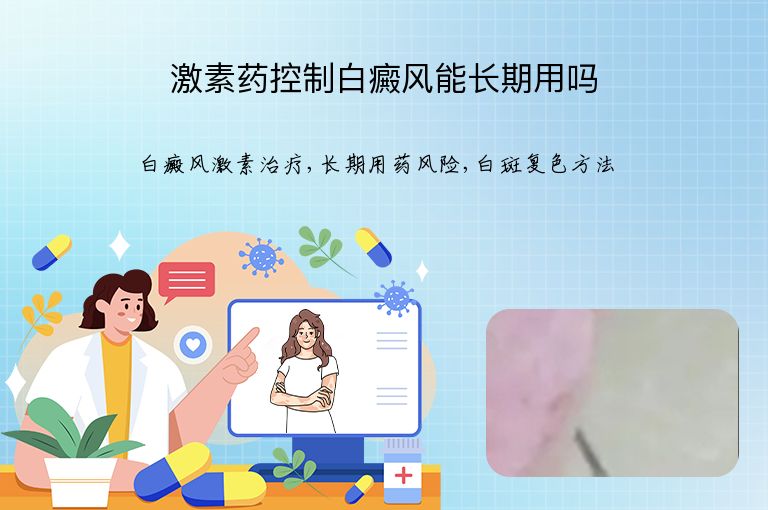 激素药控制白癜风能长期用吗”