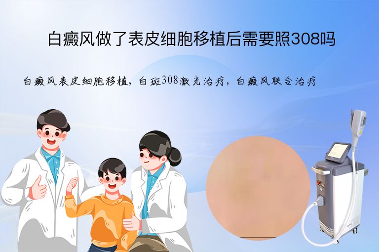白癜风做了表皮细胞移植后需要照308吗”