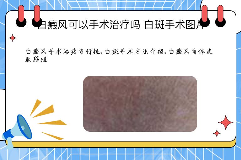 白癜风可以手术治疗吗 白斑手术图片”