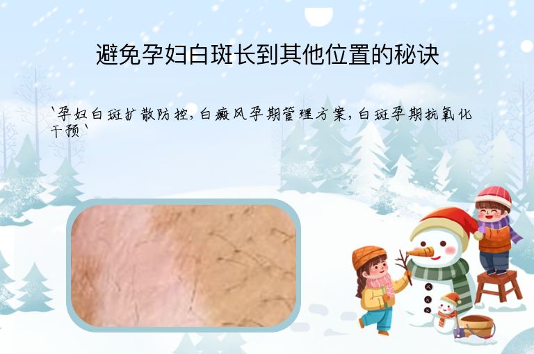 避免孕妇白斑长到其他位置的秘诀