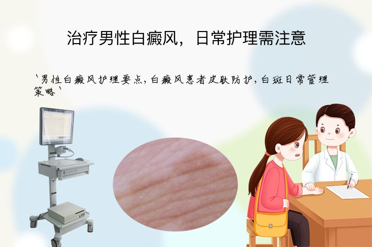 治疗男性白癜风,日常护理需注意