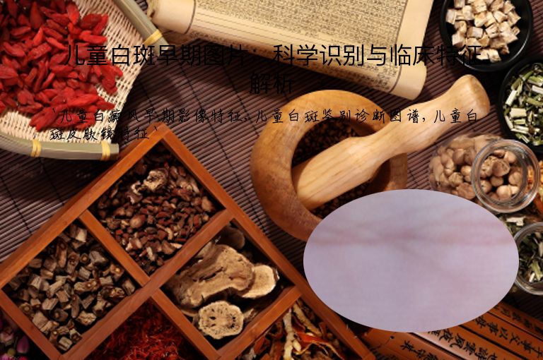 儿童白斑早期图片：科学识别与临床特征解析