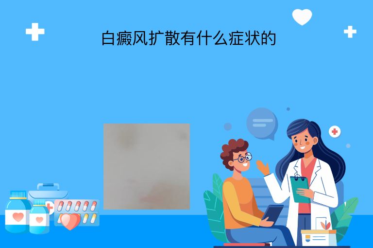 白癜风扩散有什么症状的