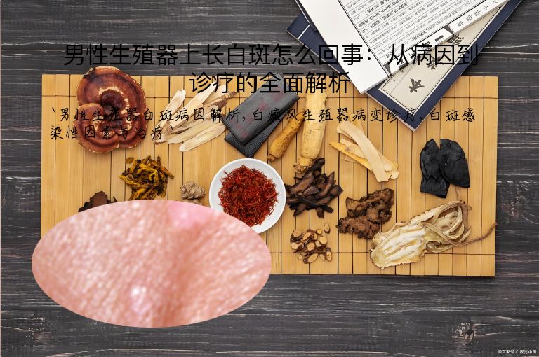 男性生殖器上长白斑怎么回事：从病因到诊疗的全面解析