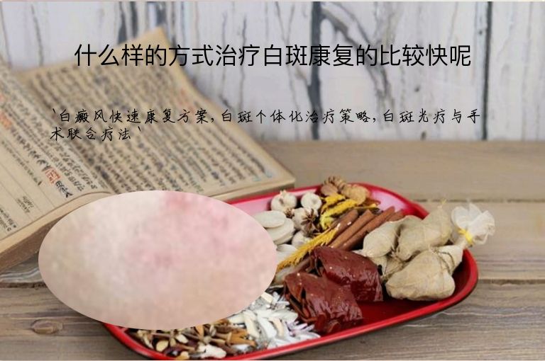 什么样的方式治疗白斑康复的比较快呢