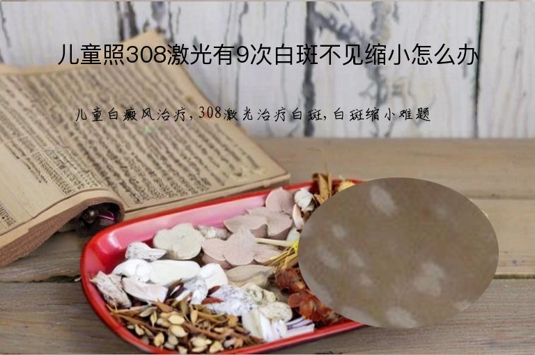 https://www.bdfsjzyy.com/d/file/p/46eda96261147b3a878d1b78c066808a.jpeg
