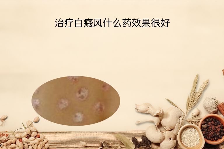 治疗白癜风什么药效果很好”