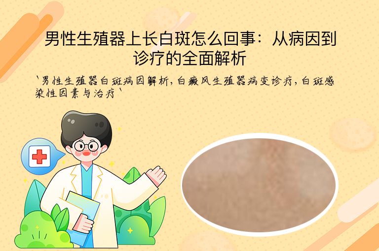 男性生殖器上长白斑怎么回事:从病因到诊疗的全面解析
