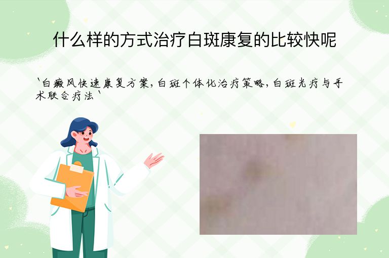 什么样的方式治疗白斑康复的比较快呢
