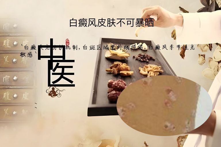 白癜风皮肤不可暴晒