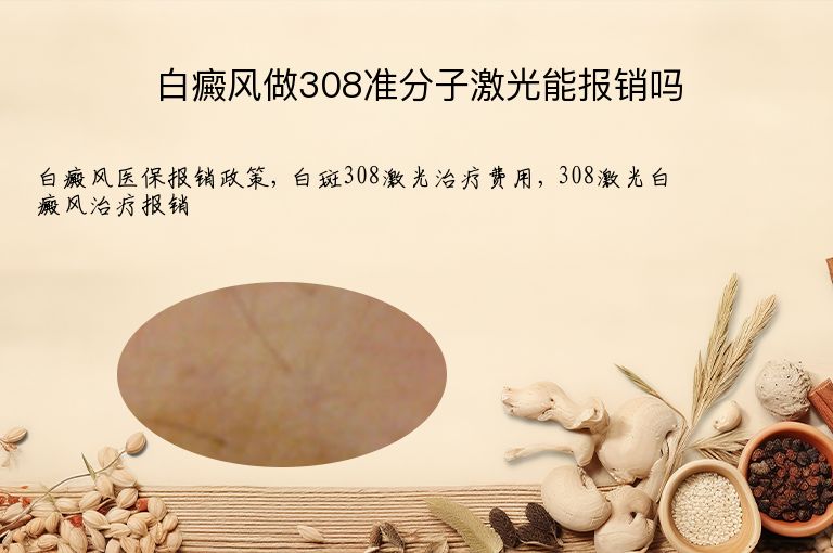 白癜风做308准分子激光能报销吗”