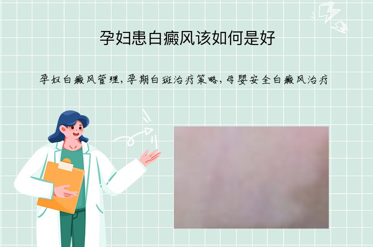 孕妇患白癜风该如何是好”
