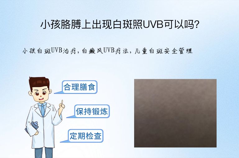 小孩胳膊上出现白斑照UVB可以吗?”