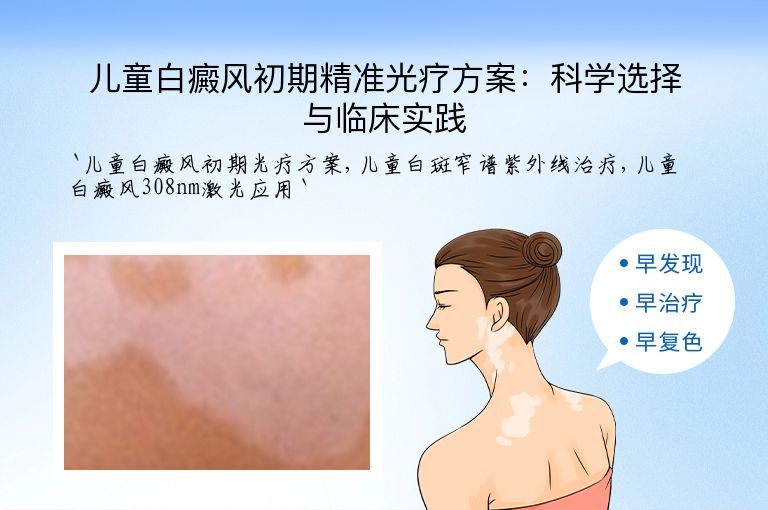儿童白癜风初期精准光疗方案：科学选择与临床实践