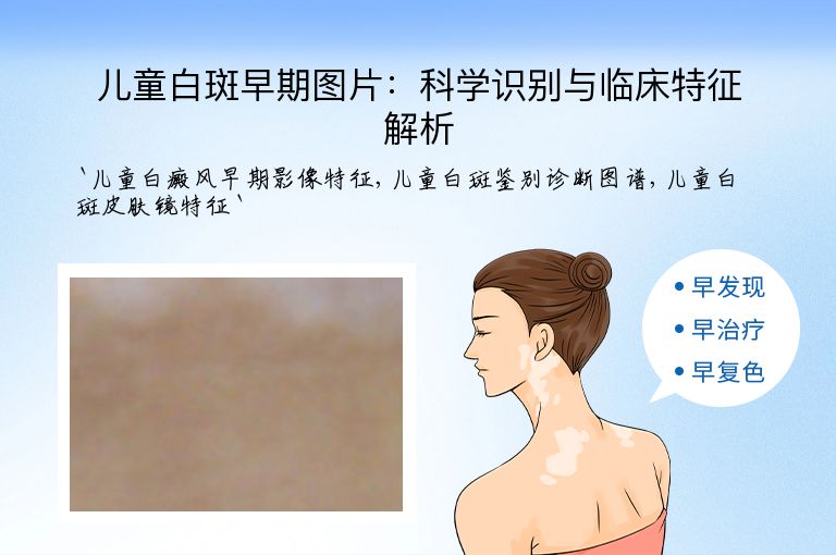 儿童白斑早期图片：科学识别与临床特征解析