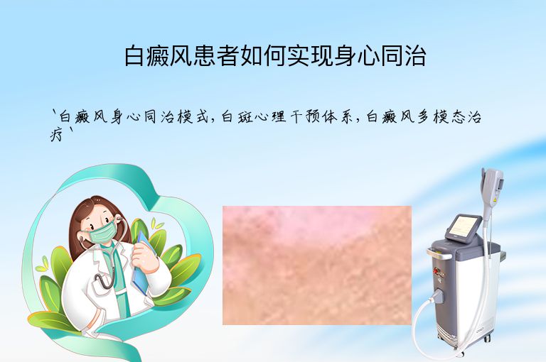 白癜风患者如何实现身心同治”