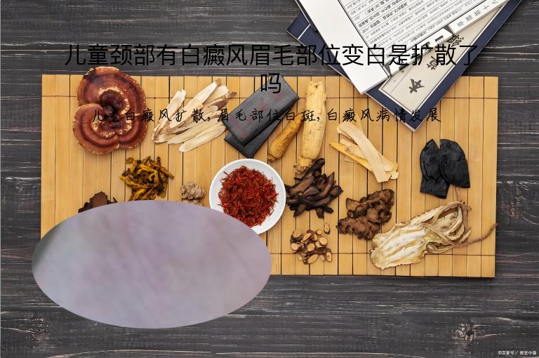儿童颈部有白癜风眉毛部位变白是扩散了吗”