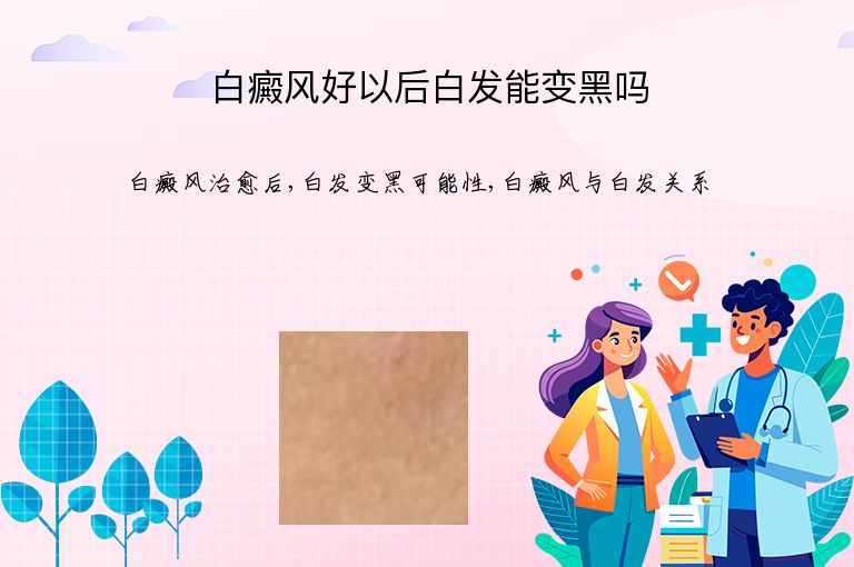 白癜风好以后白发能变黑吗”
