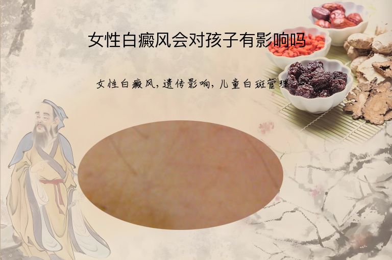 女性白癜风会对孩子有影响吗”