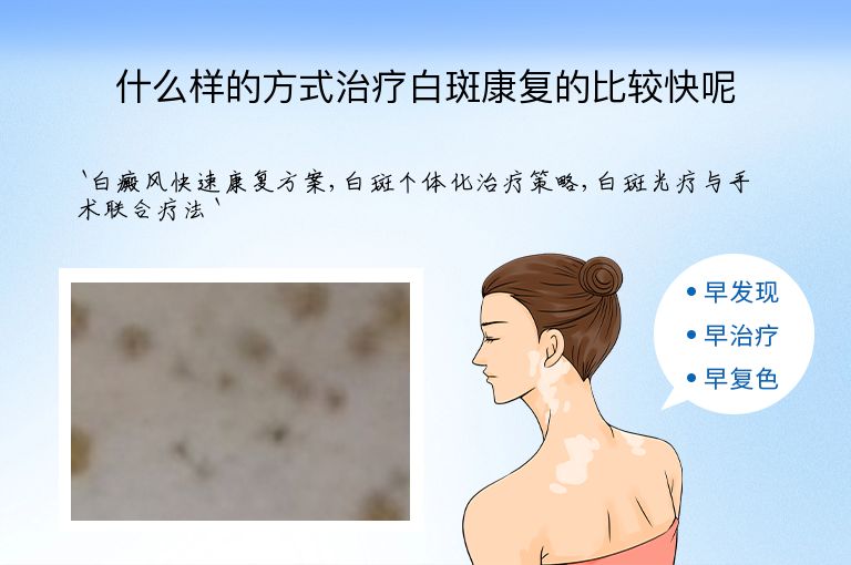 什么样的方式治疗白斑康复的比较快呢