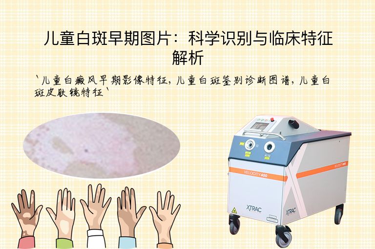 儿童白斑早期图片:科学识别与临床特征解析