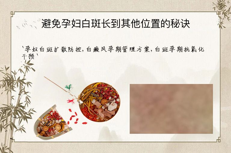 避免孕妇白斑长到其他位置的秘诀