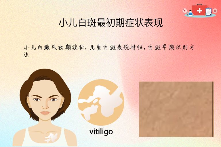 小儿白斑最初期症状表现”