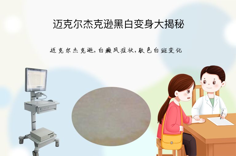 迈克尔杰克逊黑白变身大揭秘”