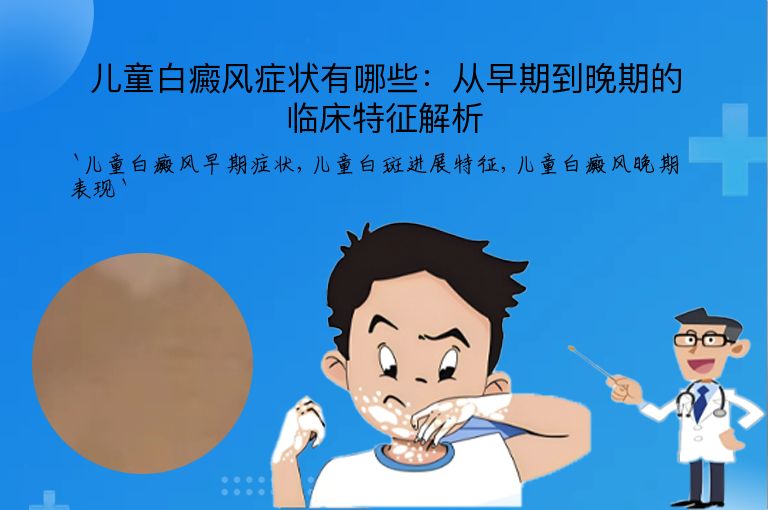 儿童白癜风症状有哪些:从早期到晚期的临床特征解析
