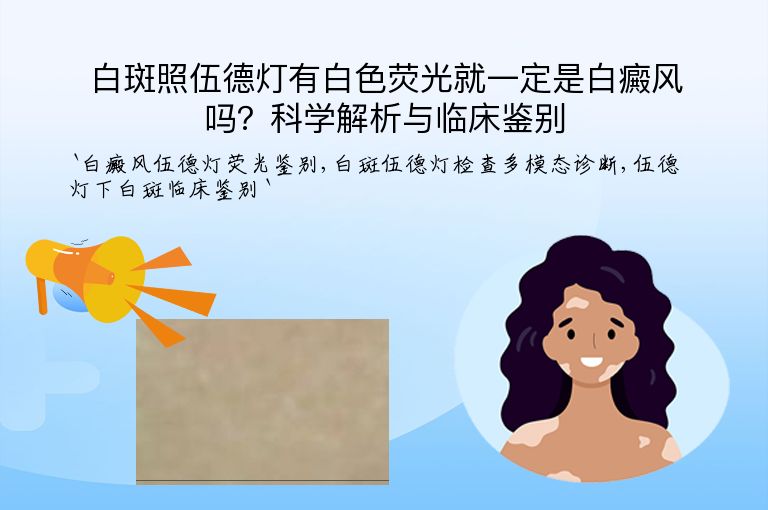 白斑照伍德灯有白色荧光就一定是白癜风吗?科学解析与临床鉴别”