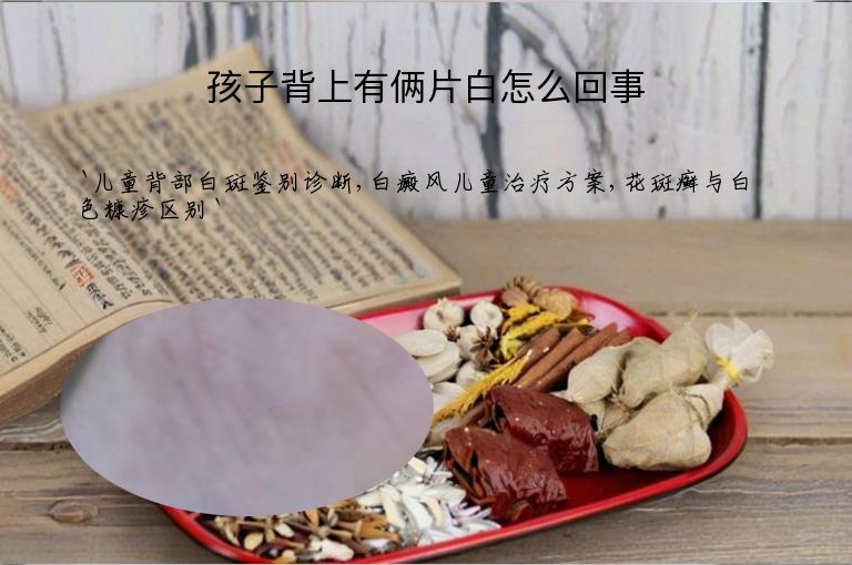 孩子背上有俩片白怎么回事