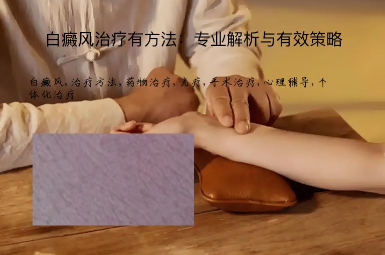白癜风治疗有方法：专业解析与有效策略”