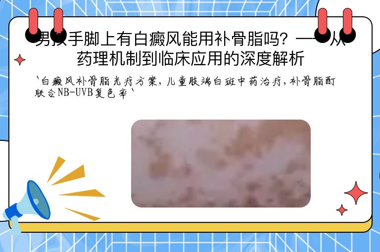 男孩手脚上有白癜风能用补骨脂吗?——从药理机制到临床应用的深度解析