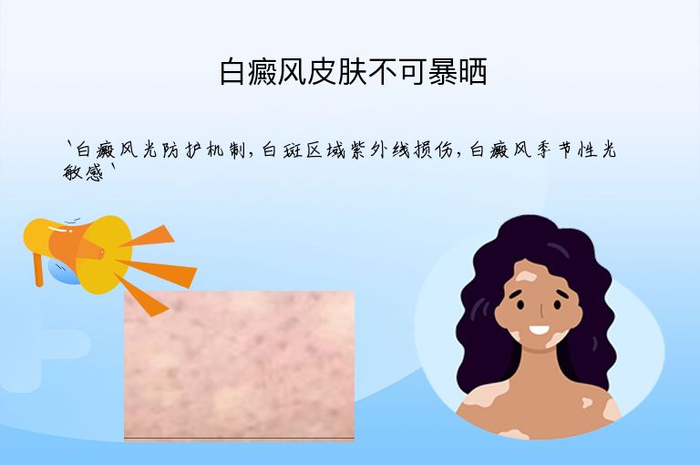 白癜风皮肤不可暴晒