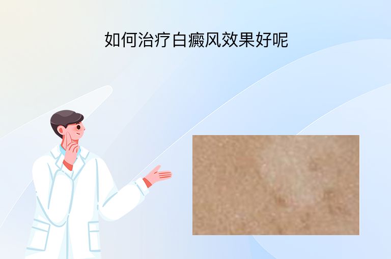 如何治疗白癜风效果好呢”