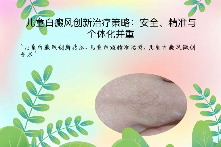 儿童白癜风创新治疗策略:安全、精准与个体化并重