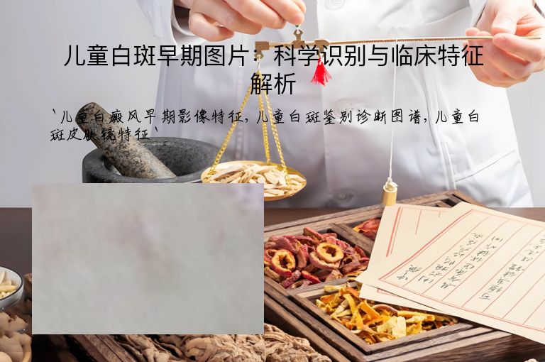 儿童白斑早期图片:科学识别与临床特征解析