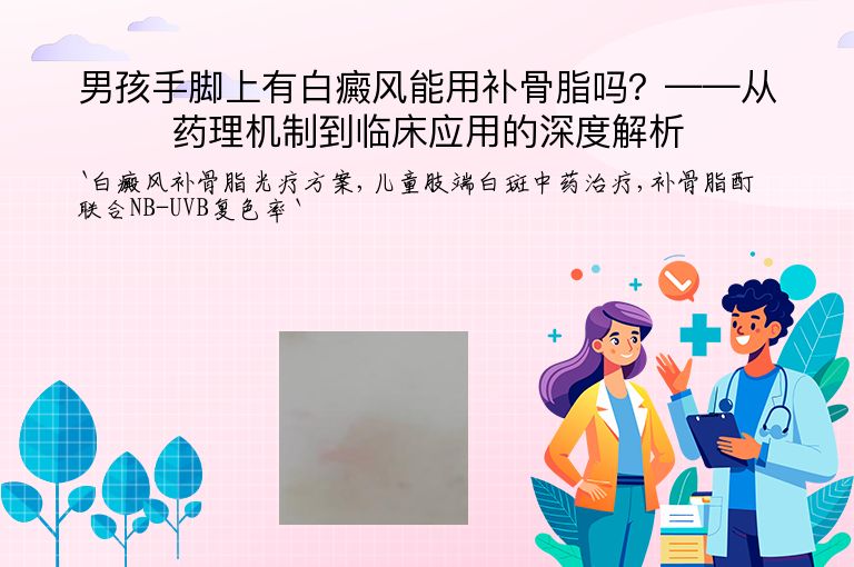 男孩手脚上有白癜风能用补骨脂吗？——从药理机制到临床应用的深度解析