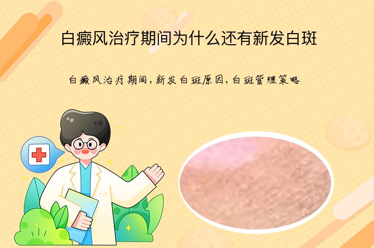 白癜风治疗期间为什么还有新发白斑”